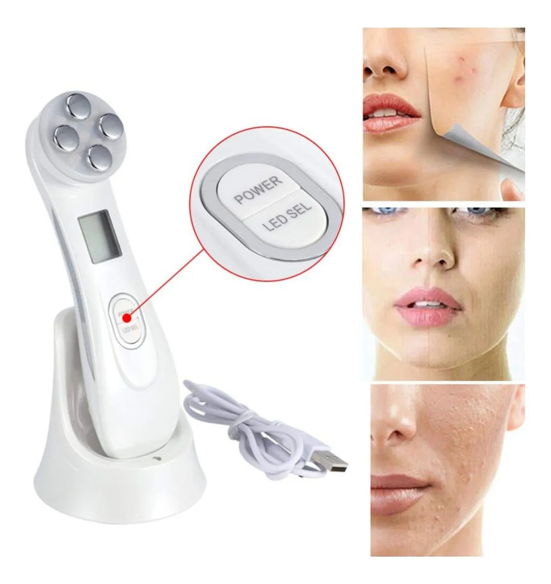 Masajeador Facial ultrasonico radiofrecuencia